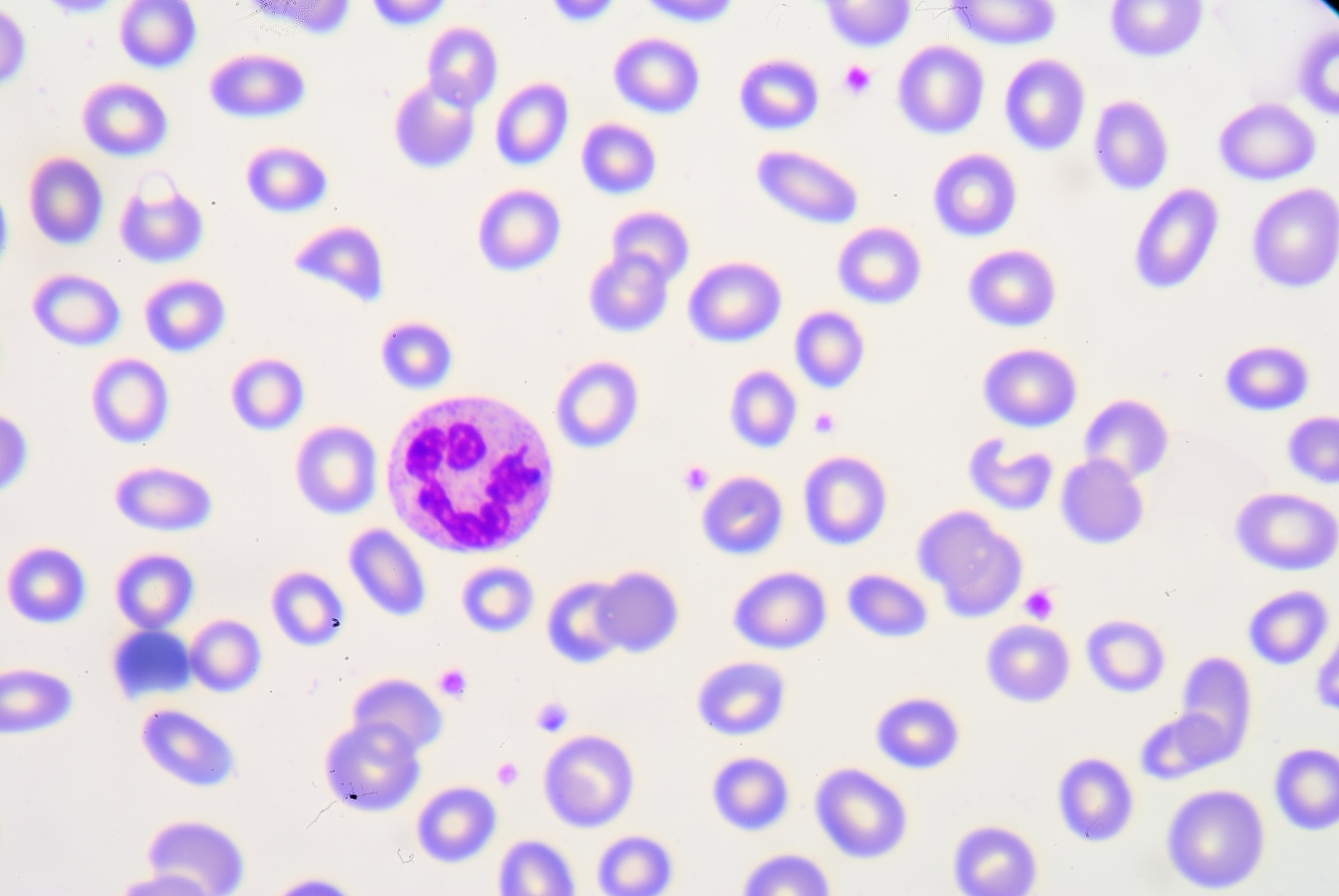 Granulocytes in the blood