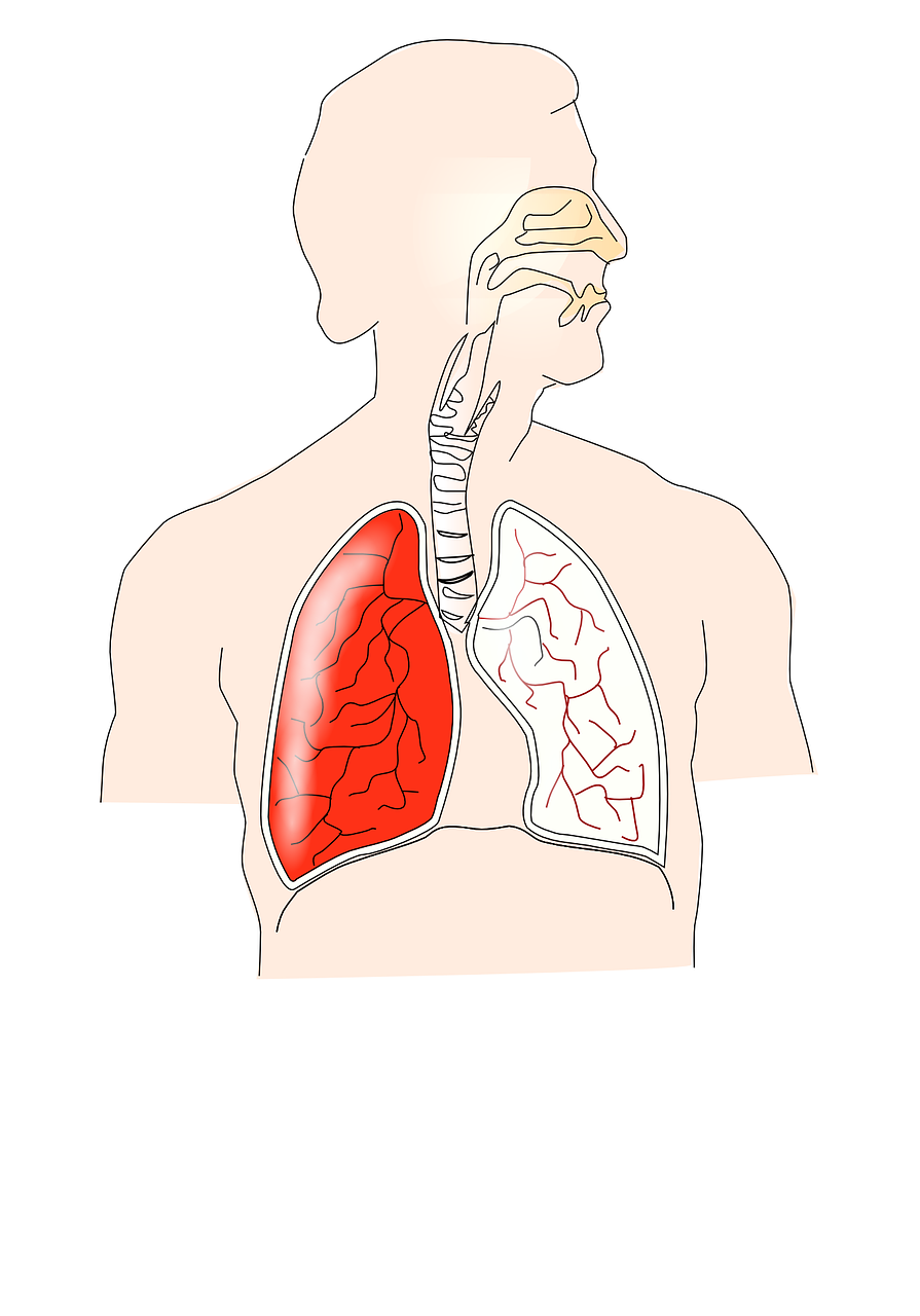 Bronchiectasis versus COPD