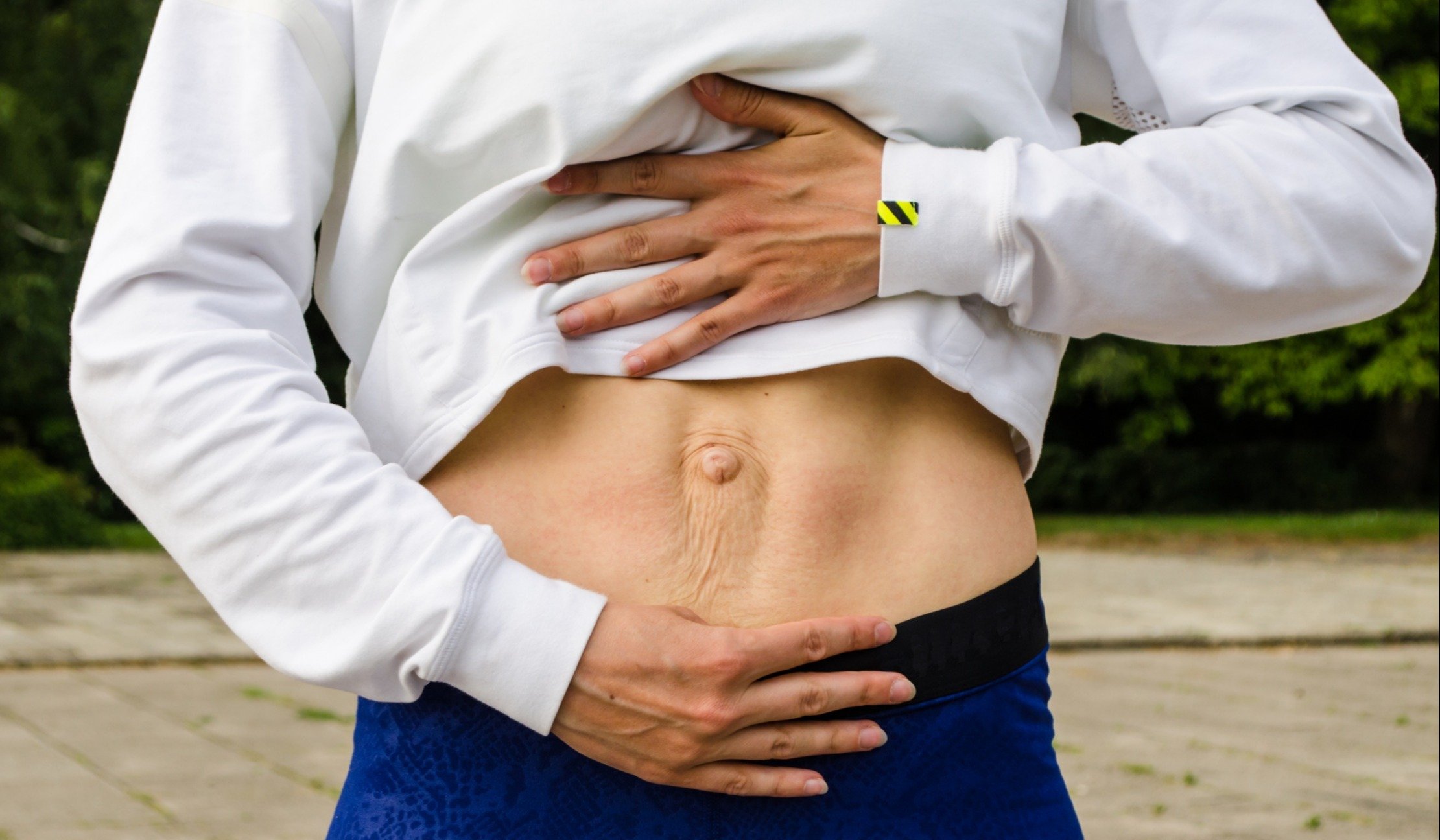 How To Check Diastasis Recti Abdominal Separation 