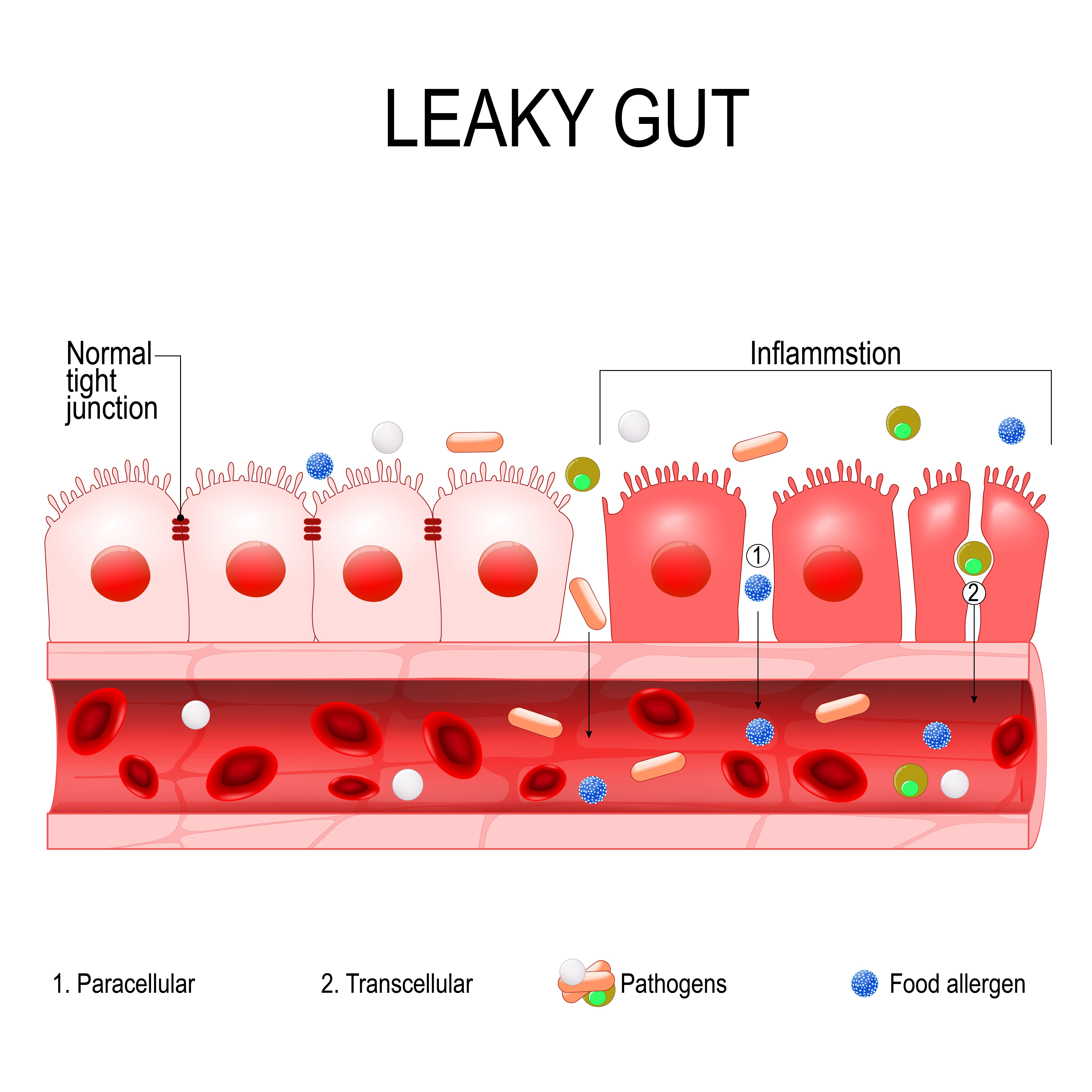 megasporebiotic leaky gut study