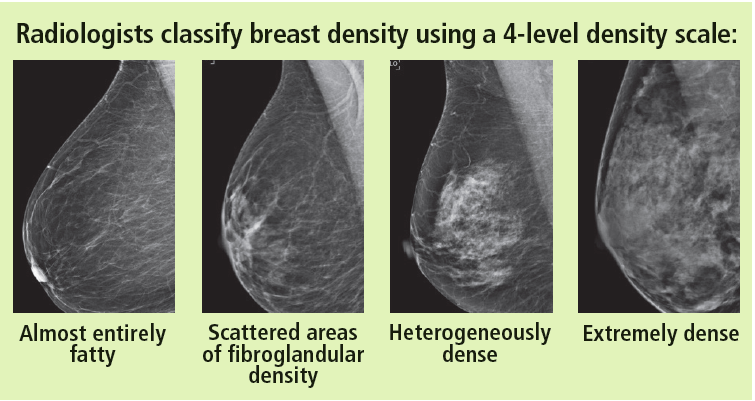 Wide variation seen in 'dense' breast diagnoses 