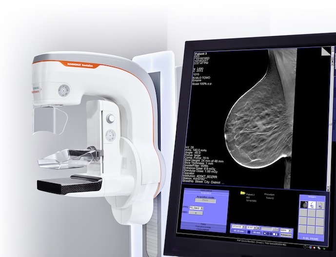 Diagnostic Imaging Blog - Cassling | Mammography