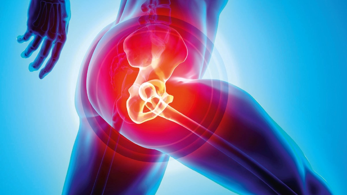 Hip Replacement Materials Best to Worst