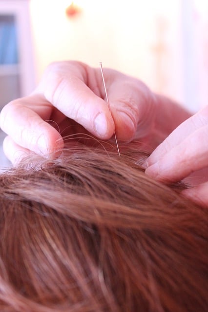 Acupuncture and Autism
