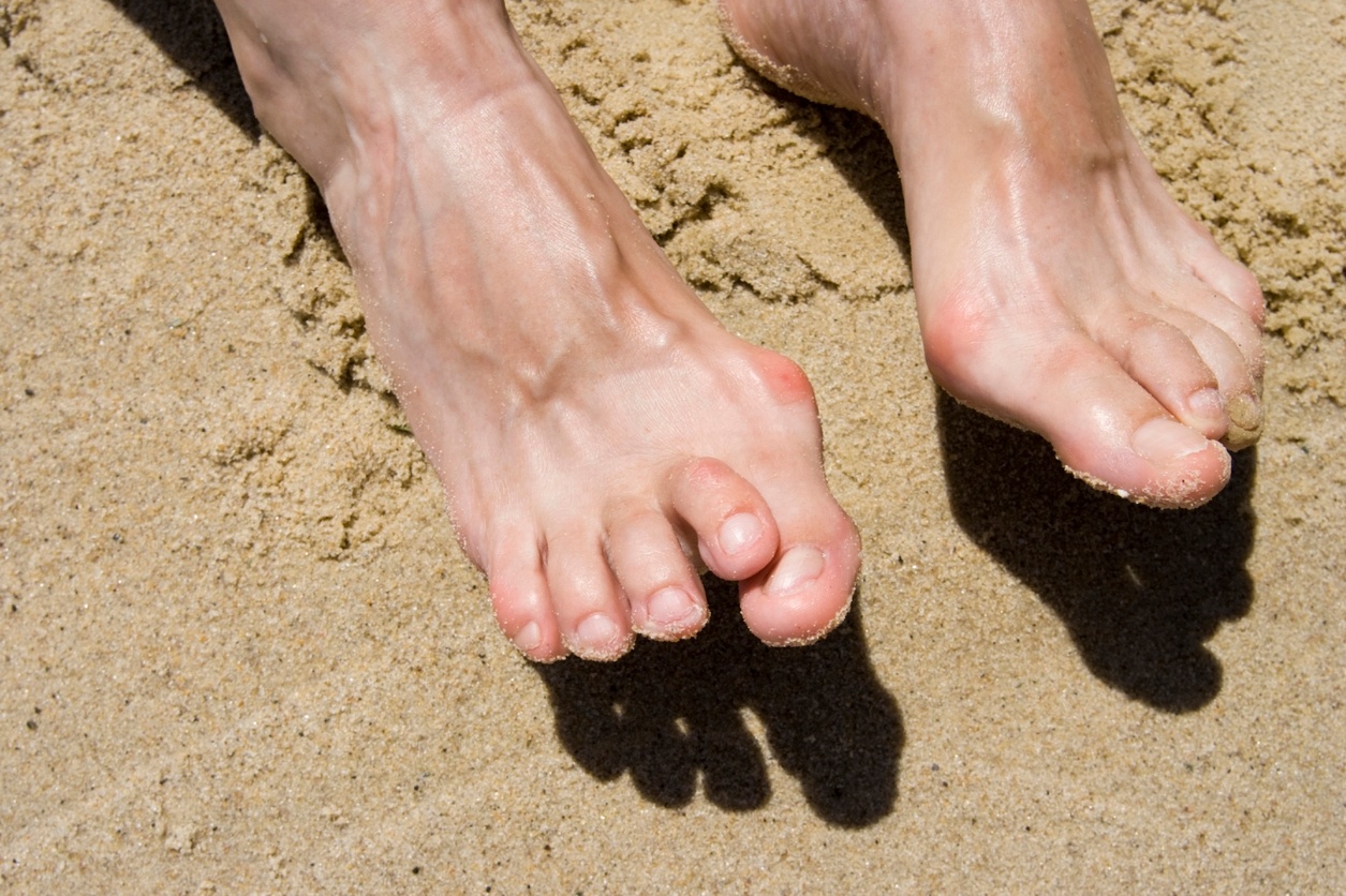 Wide Feet: Here Are the Causes and How to Break the Curse of