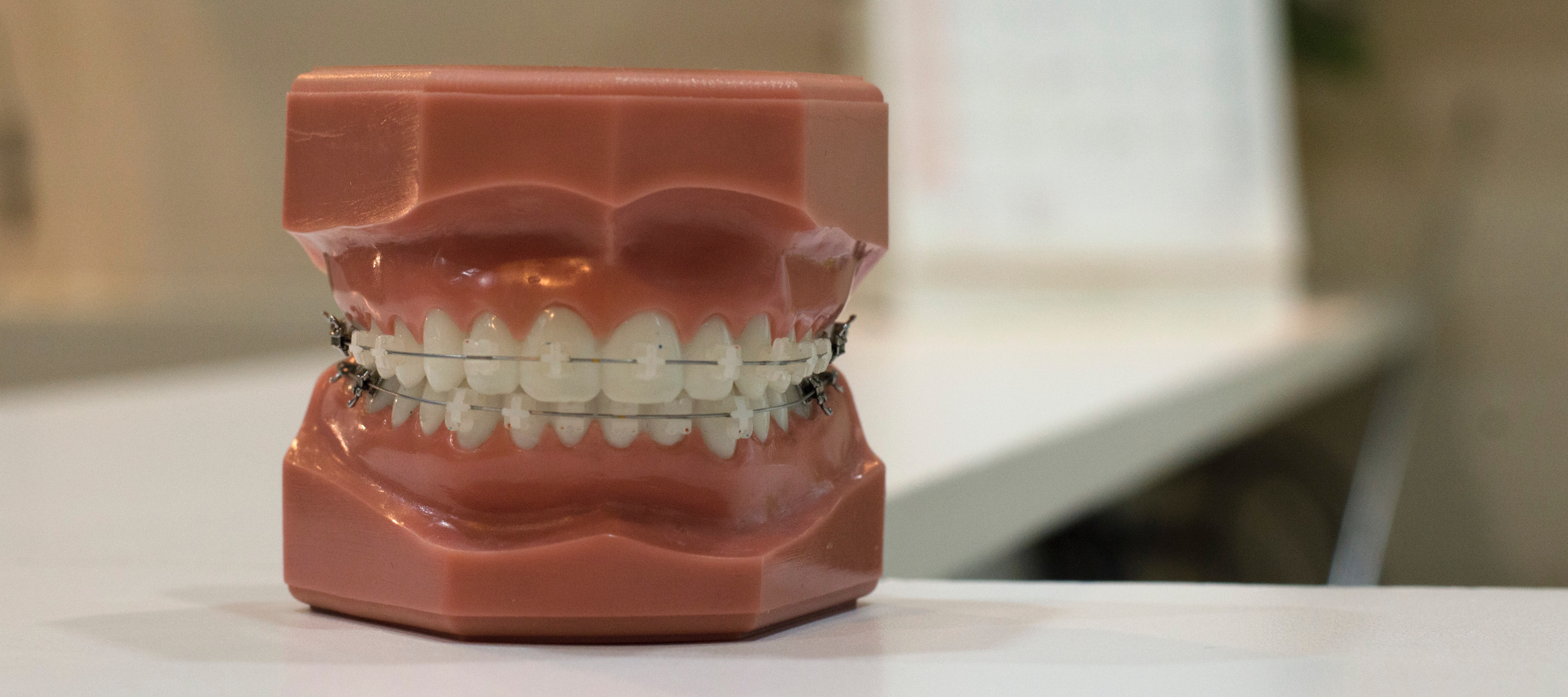 Braces vs Invisalign | Cedar Walk Dentistry