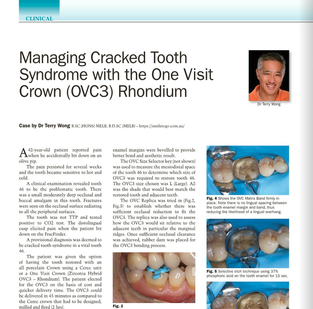 Cracked Tooth Syndrome Case Study Dr Terry Wong