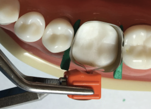 Tighten Band with Wedges in place