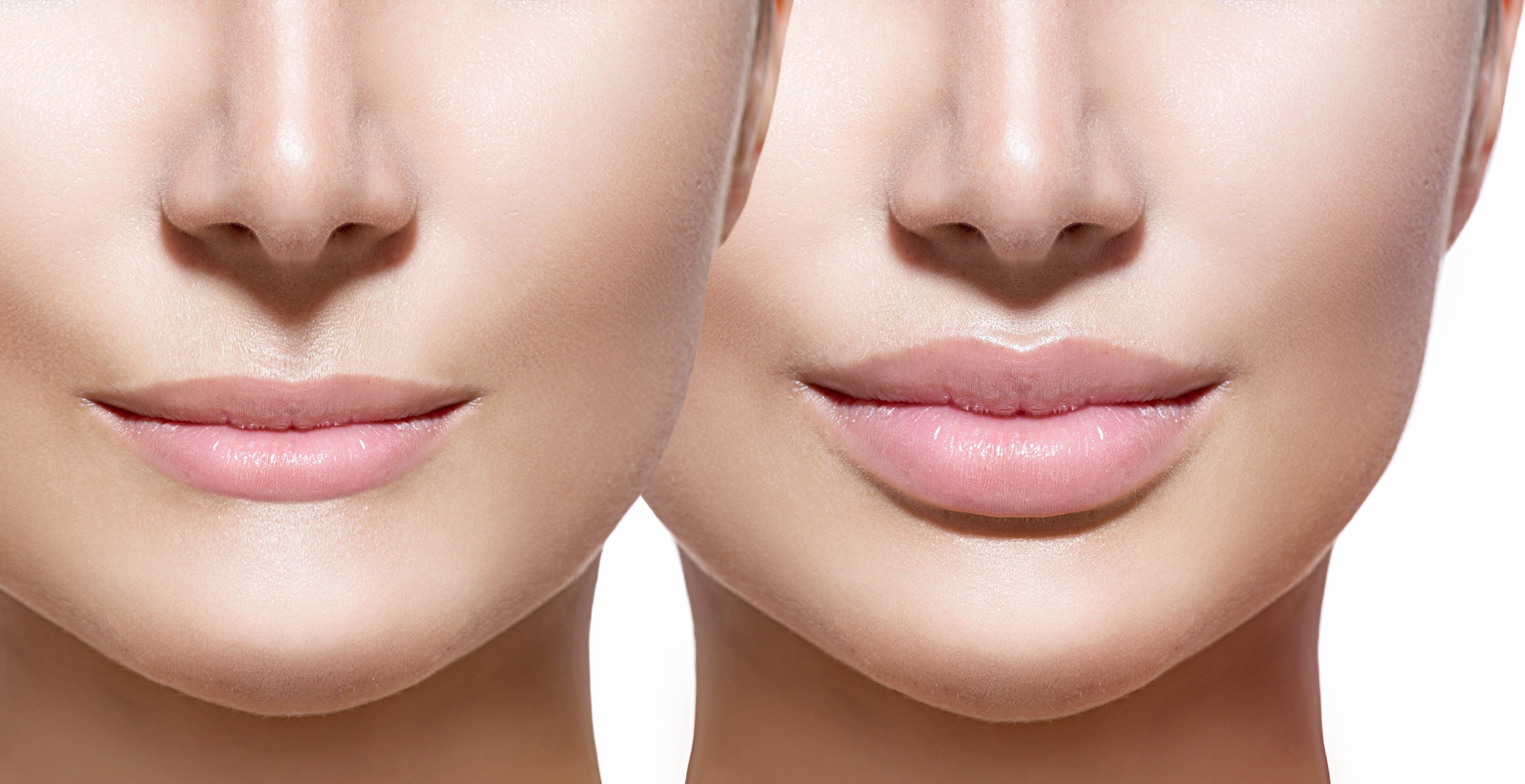 lip implant sizes