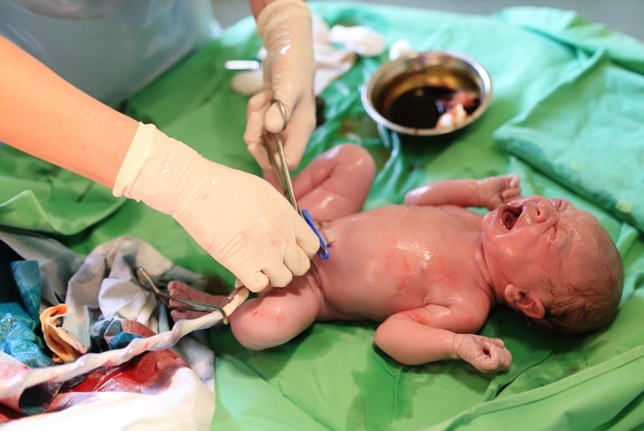 june27-umbilical-cord-a-rich-source-of-stem-cells.jpg