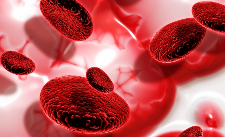 May 17 - Stem Cell Treatment Offers Hope for Sickle Cell Anemia Cure