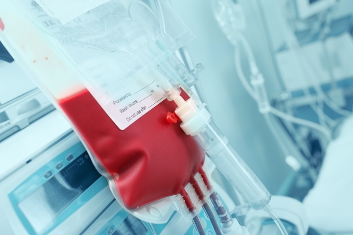 Oct 23 - Autologous & Allogenic Cord Blood Transplant