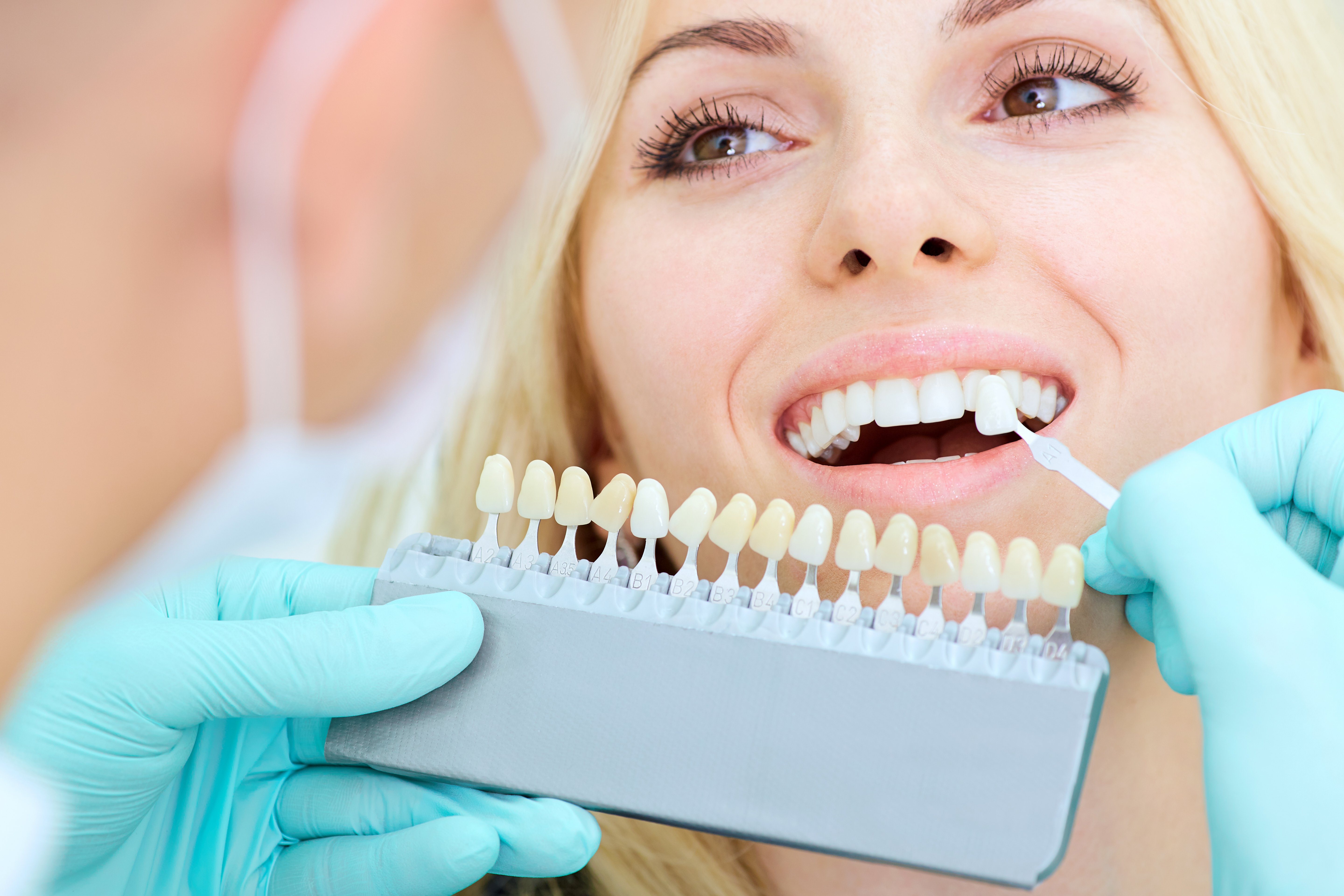 Professional Teeth Whitening Near Me