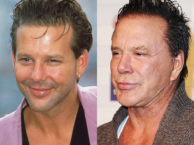 mickey-rourke-beforeafter