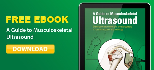 Ebook A Guide To Musculoskeletal Ultrasound - 