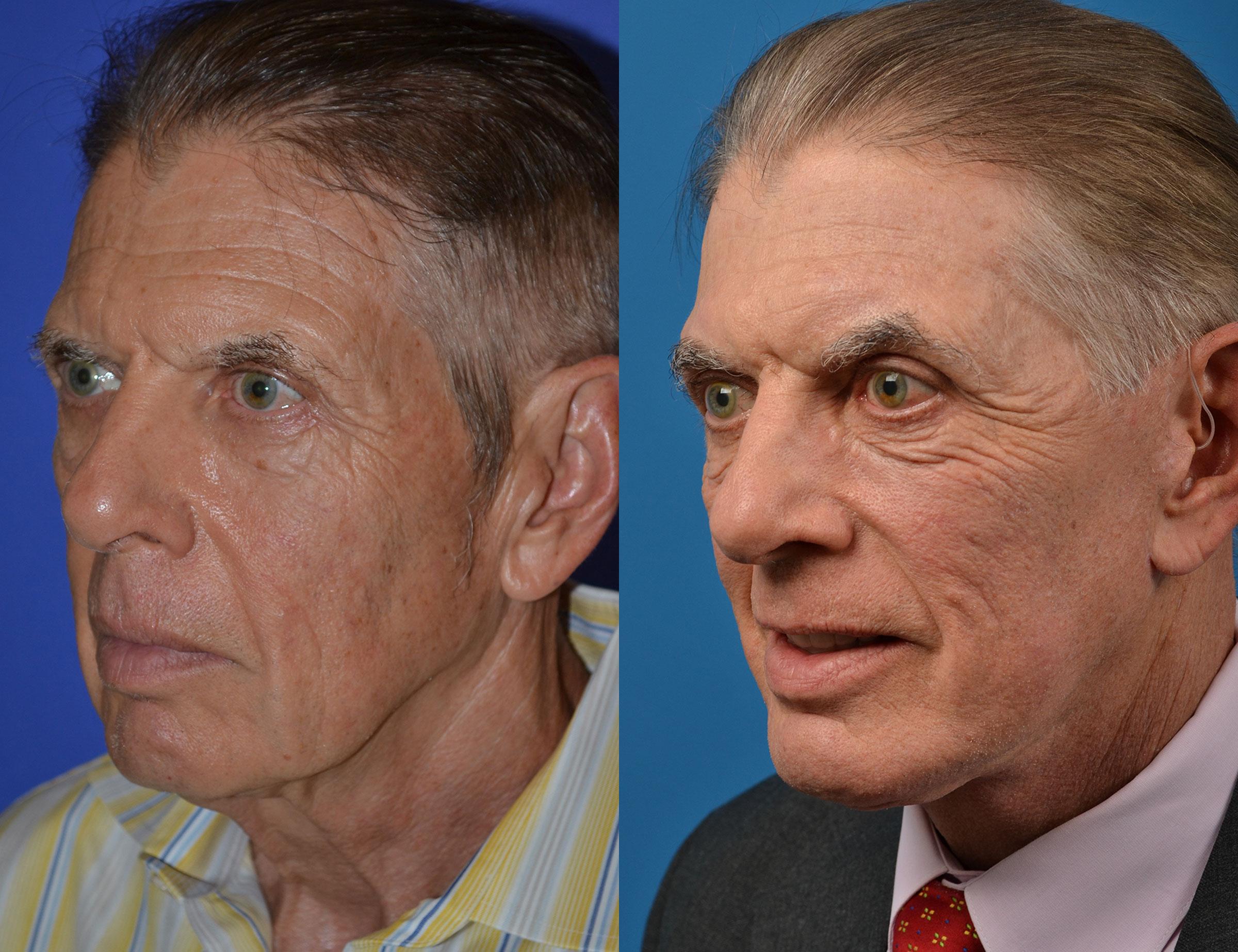 Facial Resurfacing: The Celebrity Skin Secret Revealed - 7gbyxnh