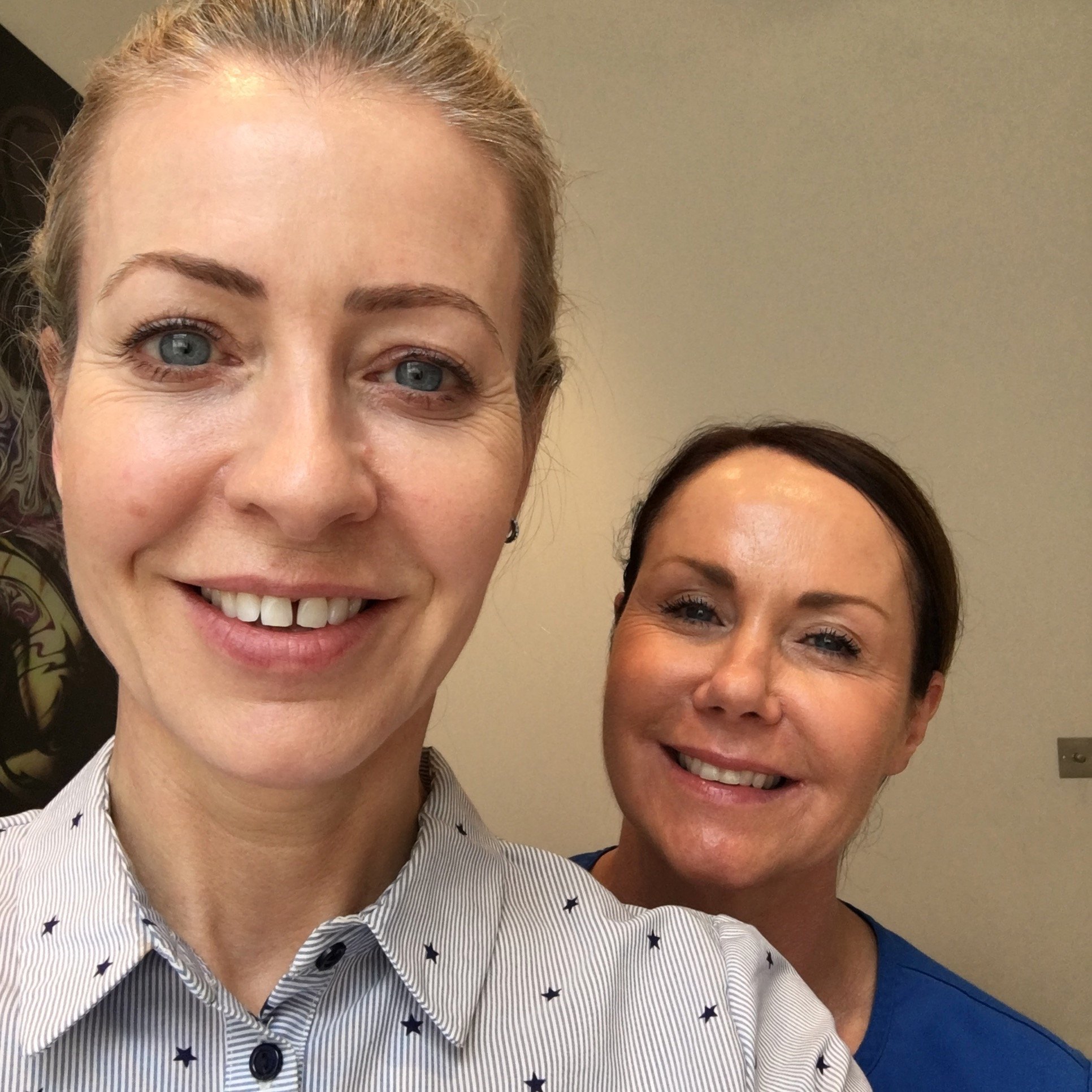  With Esther Loughran, a leading aesthetic nurse who has been doing Ultherapy for years. 