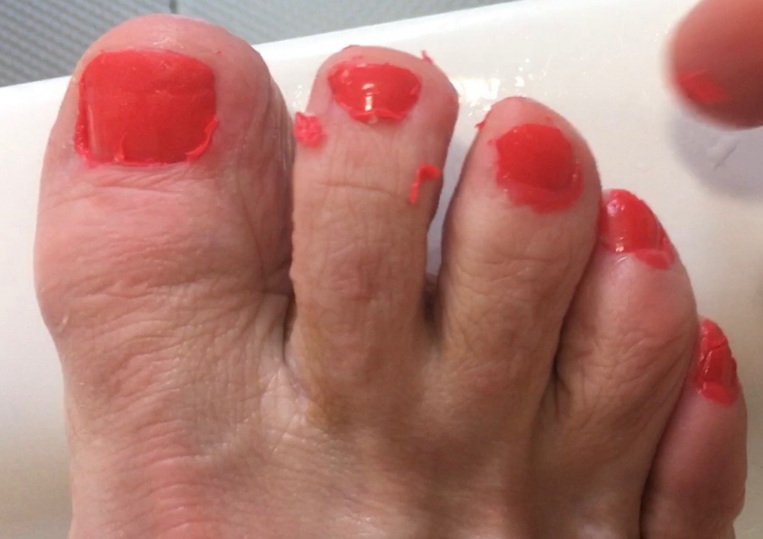 Then get peeling...