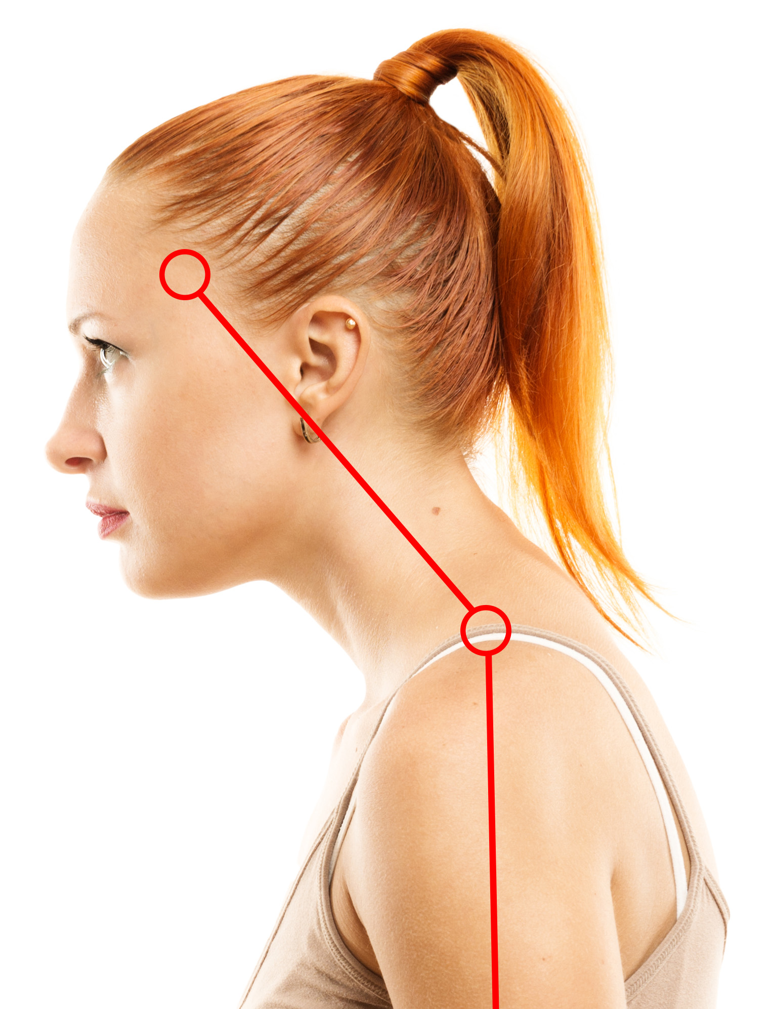 Forward neck posture