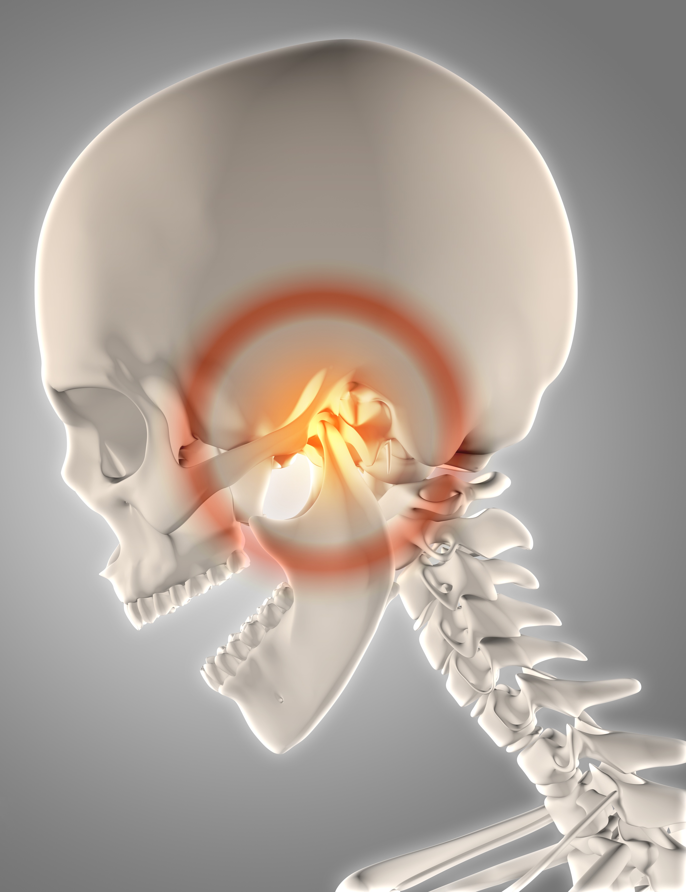 TMJ Patients