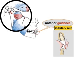 Anterior Guidance