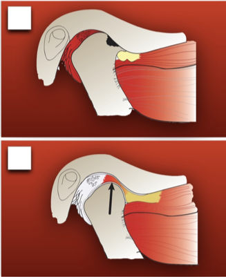 TMJ Red Joint