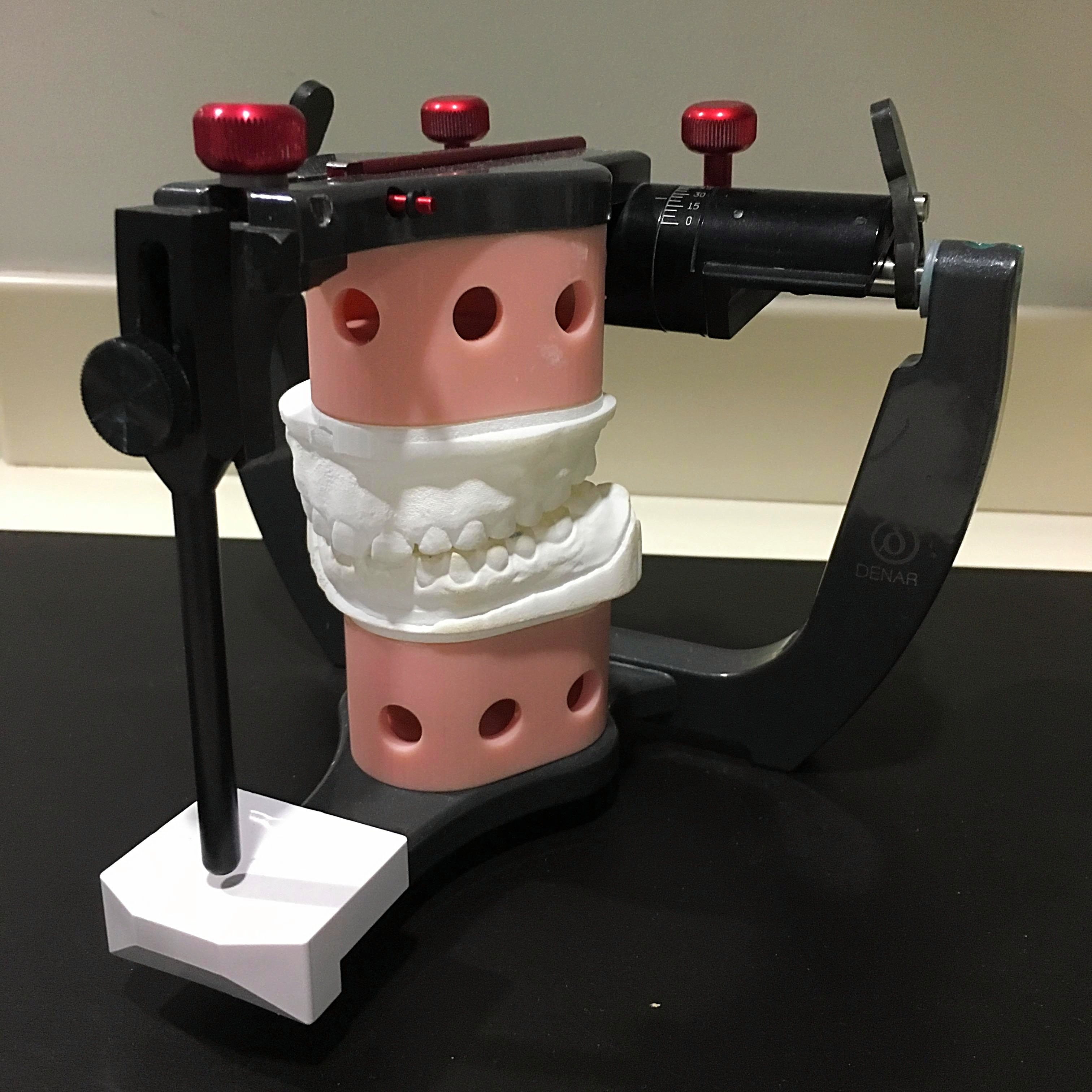 Dental Models Mounted in Centric Relation