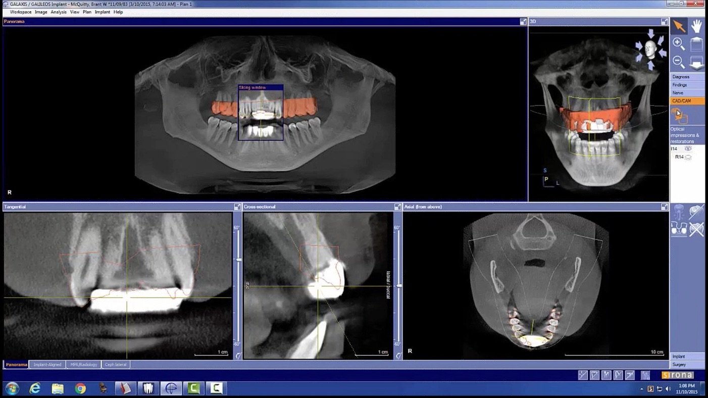 3D Imaging for Dentists